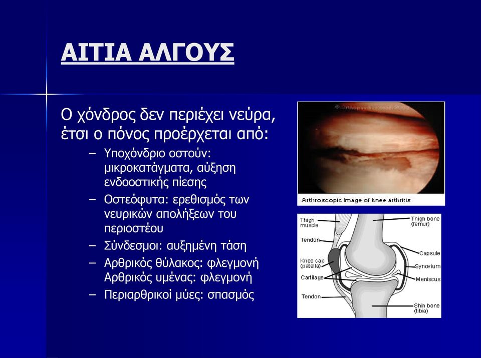 ερεθισμός των νευρικών απολήξεων του περιοστέου Σύνδεσμοι: αυξημένη τάση