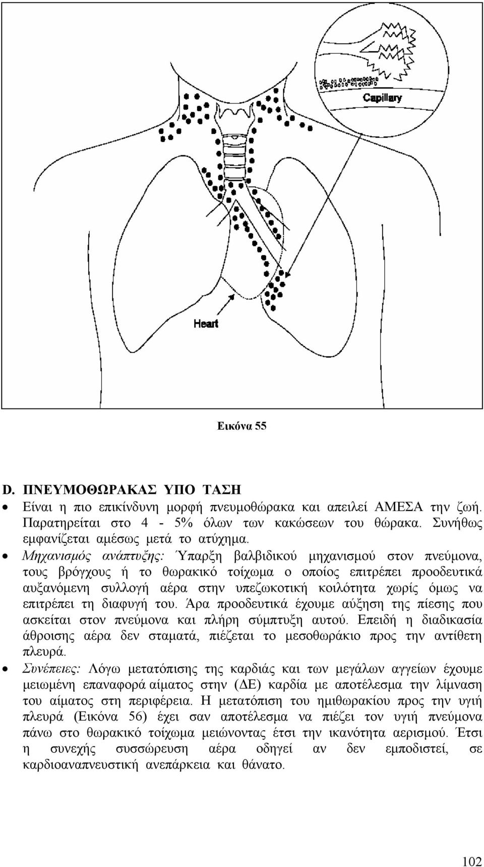 επιτρέπει τη διαφυγή του. Άρα προοδευτικά έχουμε αύξηση της πίεσης που ασκείται στον πνεύμονα και πλήρη σύμπτυξη αυτού.