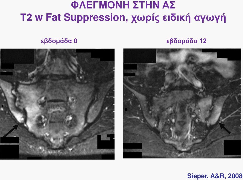 ειδική αγωγή εβδομάδα 0