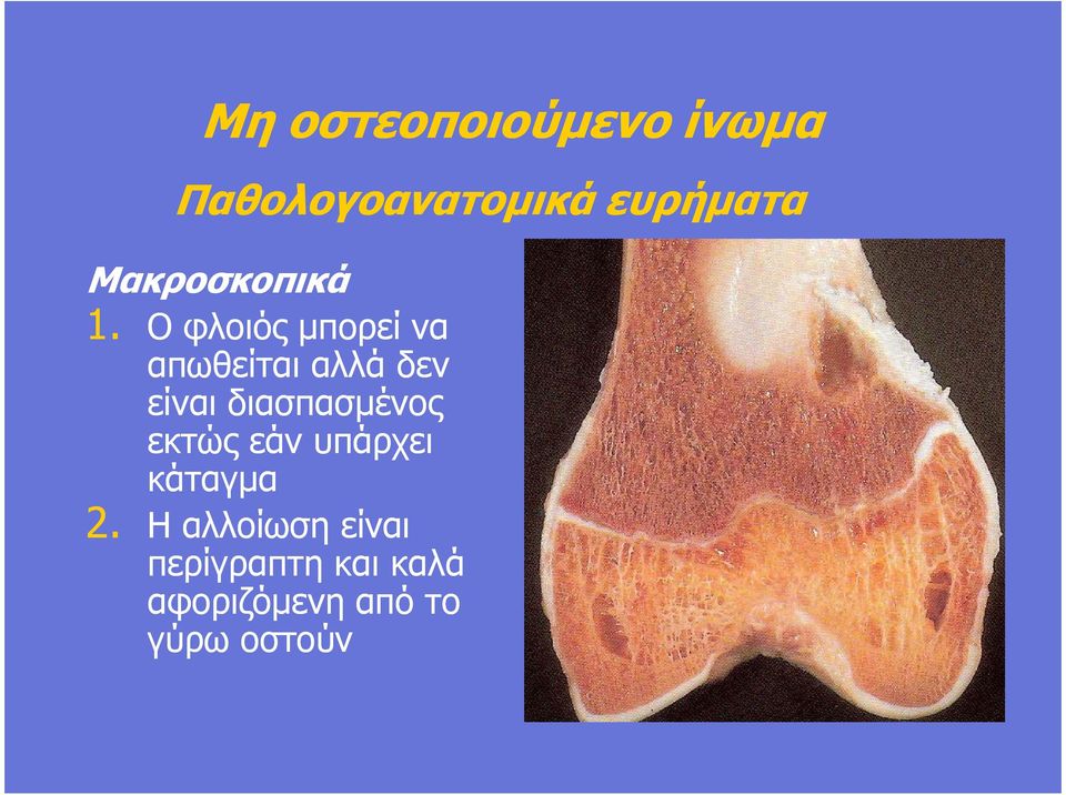 Ο φλοιός µπορεί να απωθείται αλλά δεν είναι