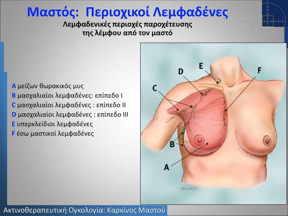 επίπεδο I C μασχαλιαίοι λεμφαδένες : επίπεδο II D μασχαλιαίοι