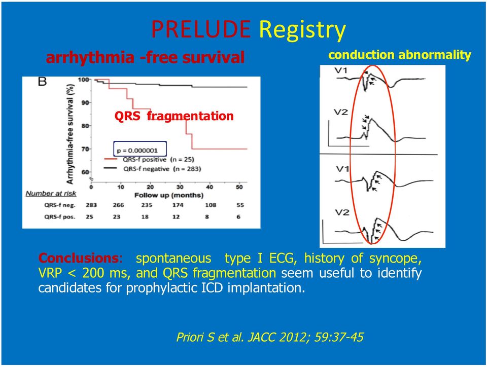 VRP < 200 ms, and QRS fragmentation seem useful to identify candidates