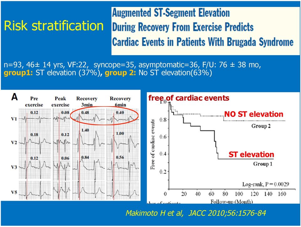 (37%), group 2: No ST elevation(63%) free of cardiac events