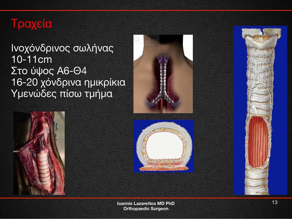 Α6-Θ4 16-20 χόνδρινα