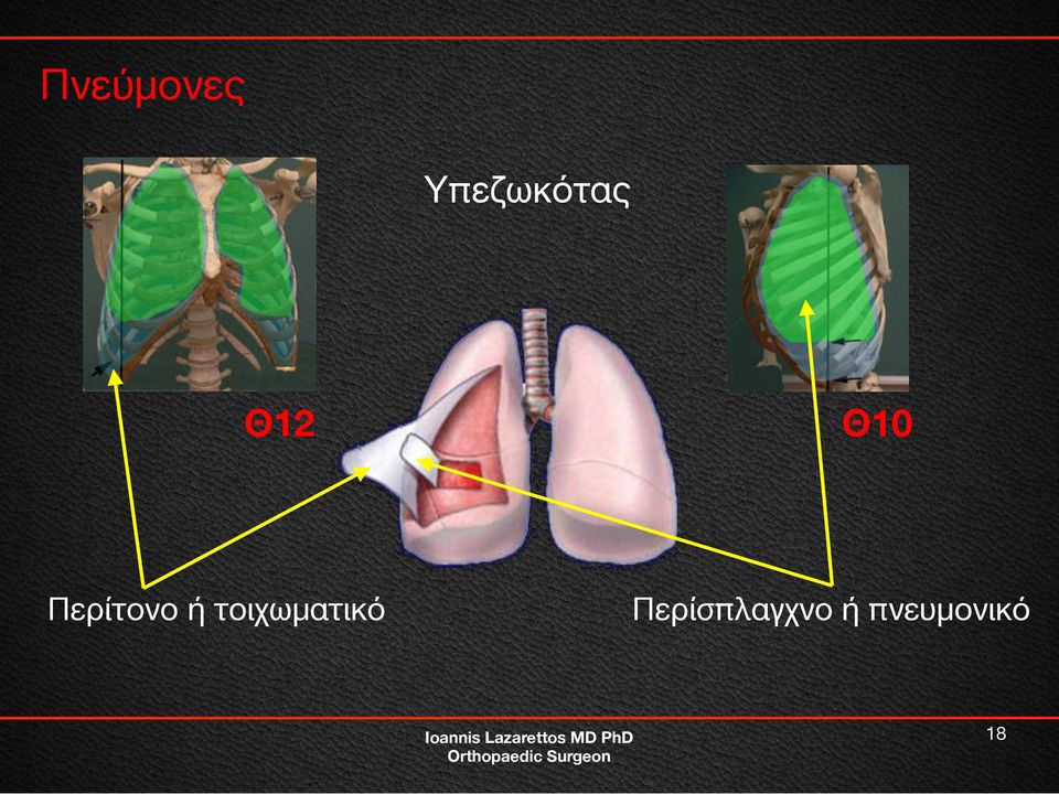 Περίτονο ή