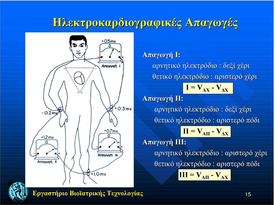 δεξί χέρι θετικό ηλεκτρόδιο : αριστερό πόδι ΙI = V ΑΠ - V ΔΧ Απαγωγή III: