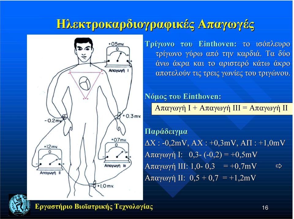 Νόμος του Einthoven: Απαγωγή I + Απαγωγή III = Απαγωγή II Παράδειγμα ΔΧ : -0,2mV, ΑΧ Χ : +0,3mV,