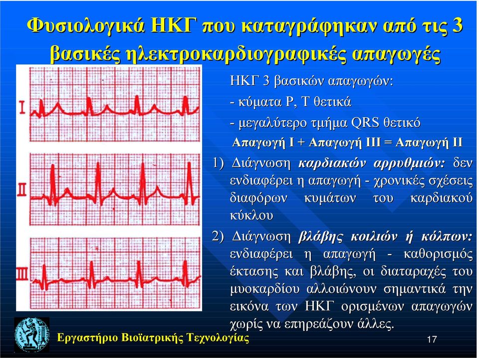 χρονικές σχέσεις διαφόρων κυμάτων του καρδιακού κύκλου 2) Διάγνωση βλάβης κοιλιών ή κόλπων: ενδιαφέρει η απαγωγή - καθορισμός