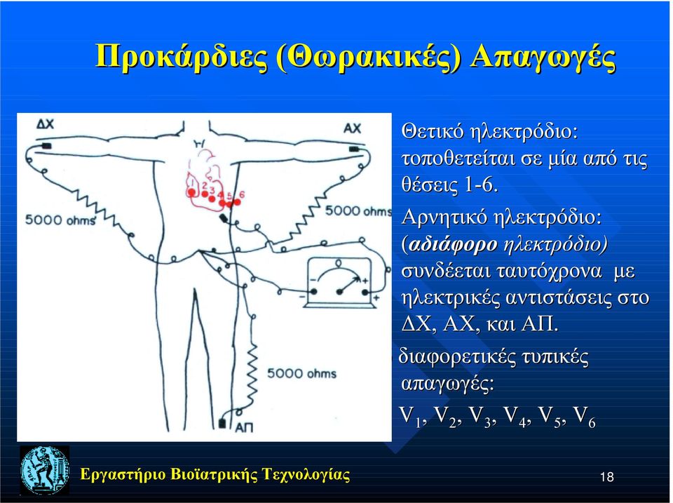 Aρνητικό ηλεκτρόδιο: (αδιάφορο ηλεκτρόδιο) συνδέεται ταυτόχρονα με