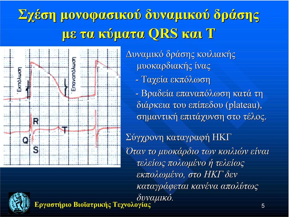 (plateau)( plateau), σημαντική επιτάχυνση στο τέλος.
