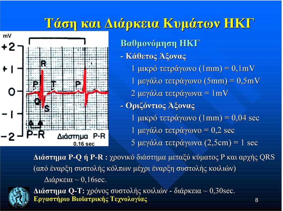 = 0,2 sec 5 μεγάλα τετράγωνα (2,5cm) = 1 sec Διάστημα P-Q ή P-R : χρoνικό διάστημα μεταξύ κύματος P και αρχής QRS (από