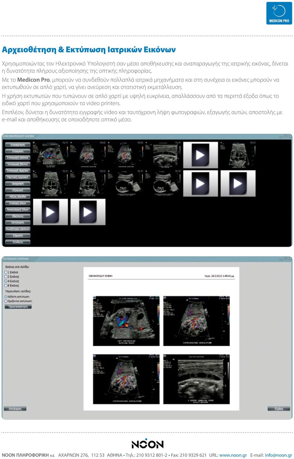 Με το Medicon Pro, μπορούν να συνδεθούν πολλαπλά ιατρικά μηχανήματα και στη συνέχεια οι εικόνες μπορούν να εκτυπωθούν σε απλό χαρτί, να γίνει ανεύρεση και στατιστική