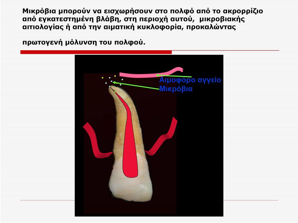 μικροβιακής αιτιολογίας ή από την αιματική κυκλοφορία,