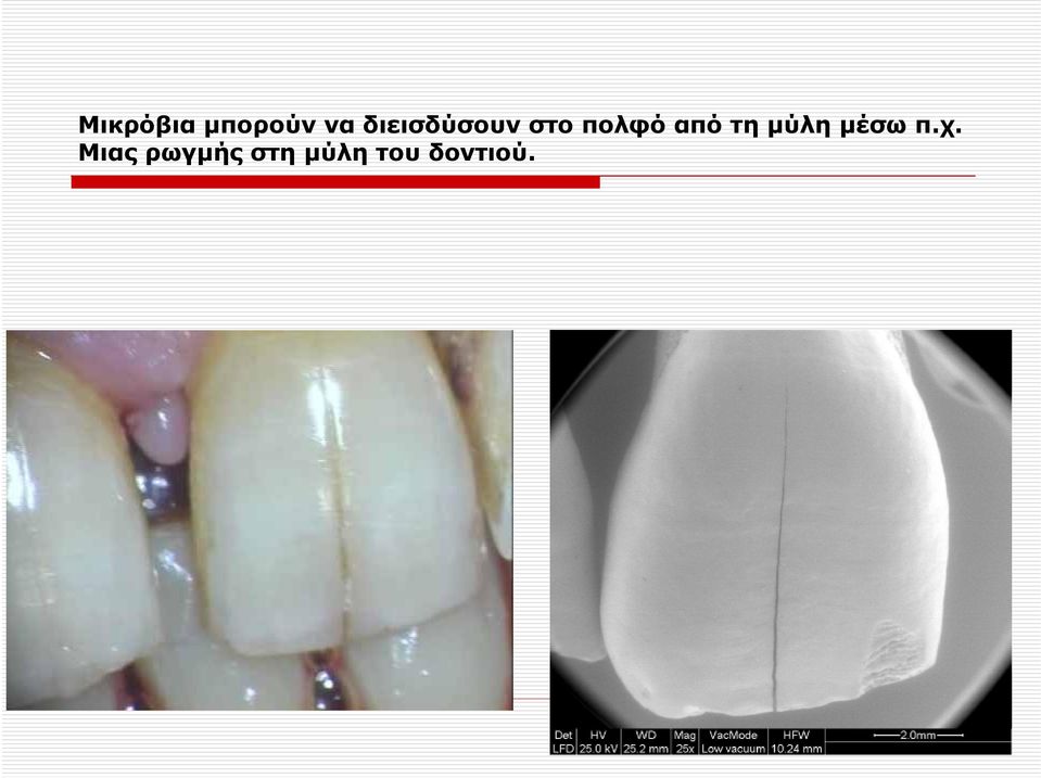από τη μύλη μέσω π.χ.