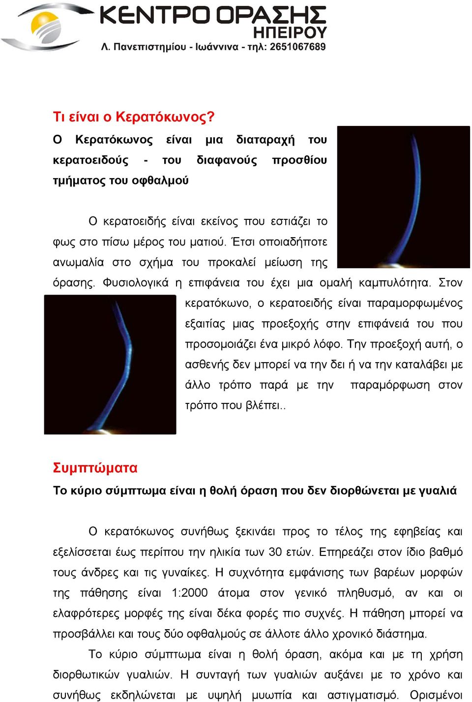 Στον κερατόκωνο, ο κερατοειδής είναι παραµορφωµένος εξαιτίας µιας προεξοχής στην επιφάνειά του που προσοµοιάζει ένα µικρό λόφο.