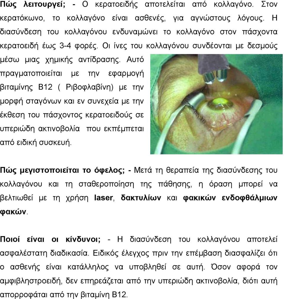 Αυτό πραγµατοποιείται µε την εφαρµογή βιταµίνης Β12 ( Ριβοφλαβίνη) µε την µορφή σταγόνων και εν συνεχεία µε την έκθεση του πάσχοντος κερατοειδούς σε υπεριώδη ακτινοβολία που εκπέµπεται από ειδική