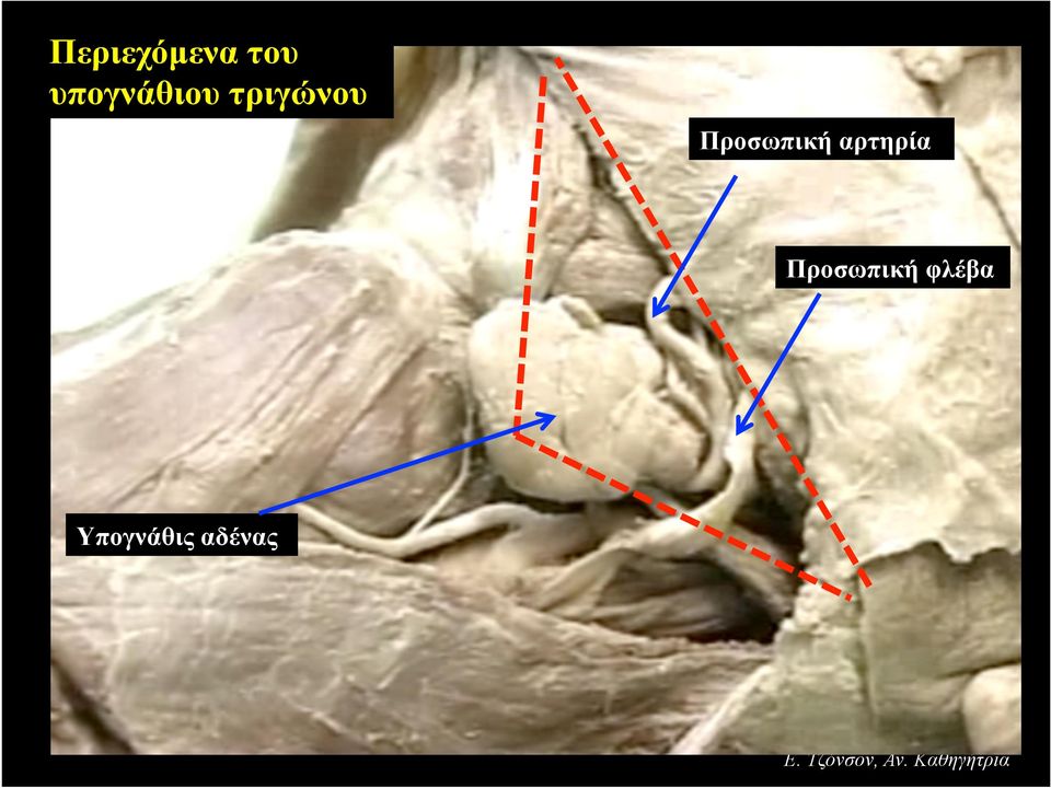 Προσωπική αρτηρία