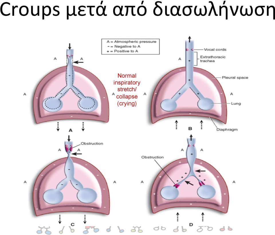 inspiratory
