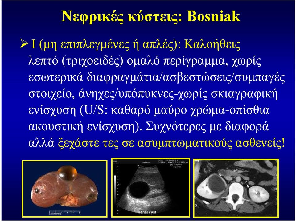 στοιχείο, άνηχες/υπόπυκνες-χωρίς σκιαγραφική ενίσχυση (U/S: καθαρό μαύρο