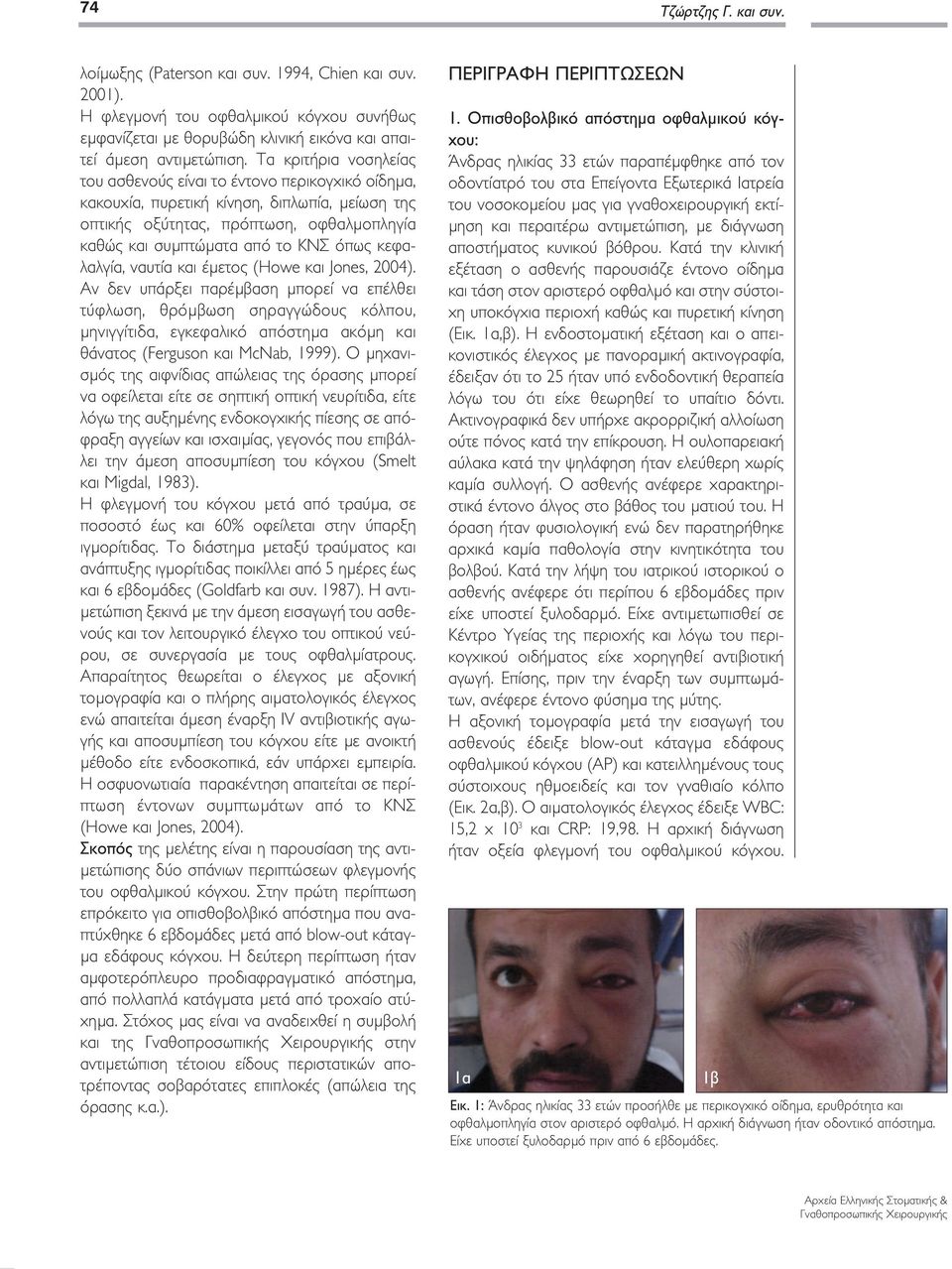 κεφαλαλγία, ναυτία και έμετος (Howe και Jones, 2004).