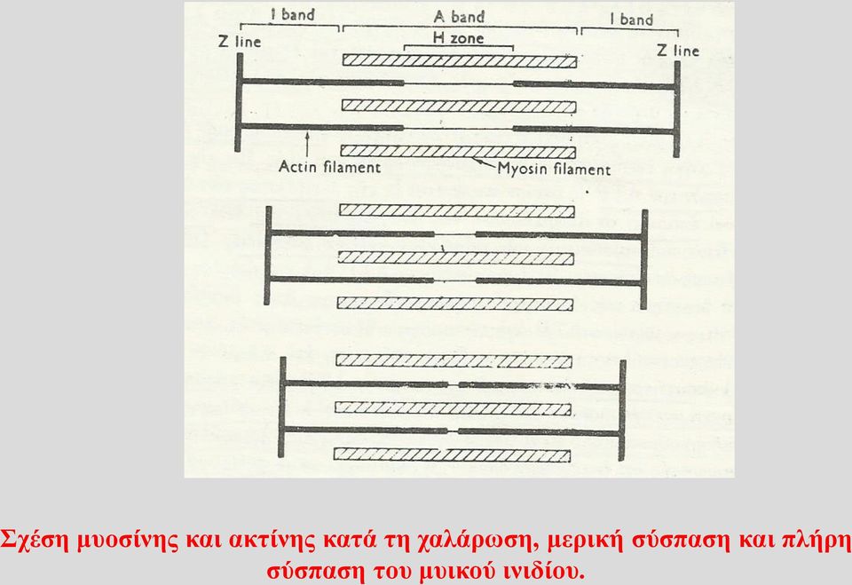 χαλάρωση, μερική σύσπαση