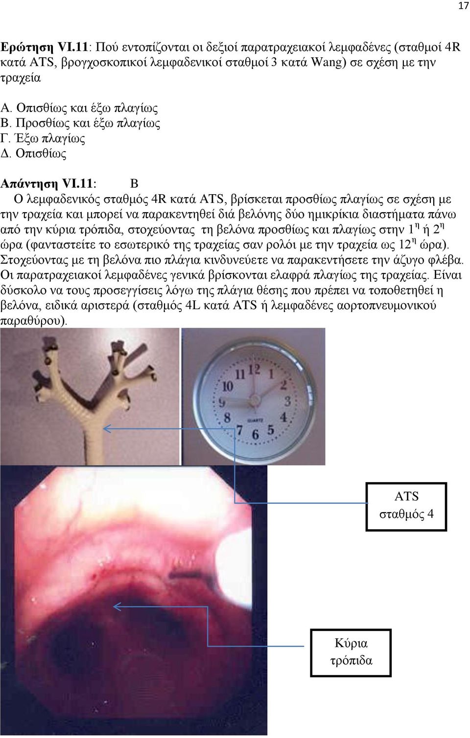 11: B Ο λεμφαδενικός σταθμός 4R κατά ATS, βρίσκεται προσθίως πλαγίως σε σχέση με την τραχεία και μπορεί να παρακεντηθεί διά βελόνης δύο ημικρίκια διαστήματα πάνω από την κύρια τρόπιδα, στοχεύοντας τη