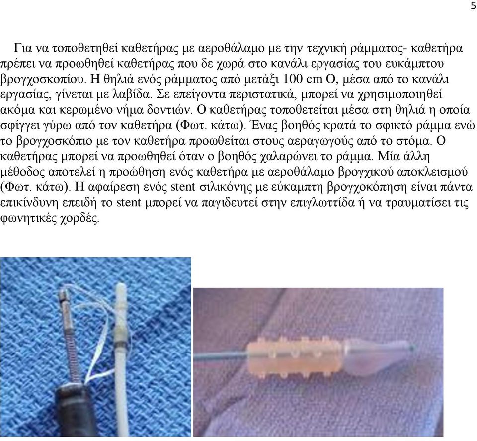 Ο καθετήρας τοποθετείται μέσα στη θηλιά η οποία σφίγγει γύρω από τον καθετήρα (Φωτ. κάτω).