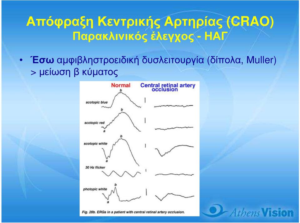 ΗΑΓ Έσω αµφιβληστροειδική