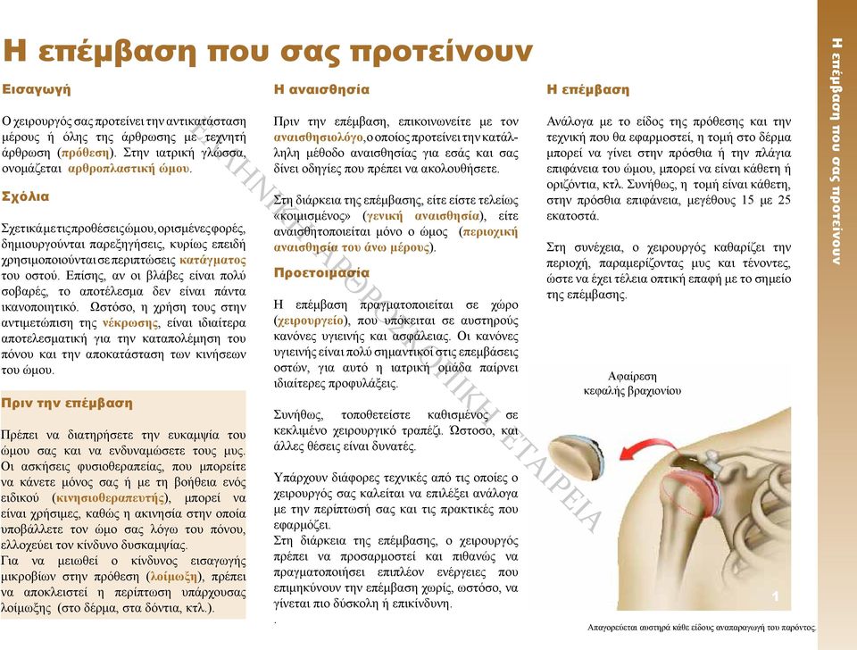 Σχόλια Σχετικά με τις προθέσεις ώμου, ορισμένες φορές, δημιουργούνται παρεξηγήσεις, κυρίως επειδή χρησιμοποιούνται σε περιπτώσεις κατάγματος του οστού.