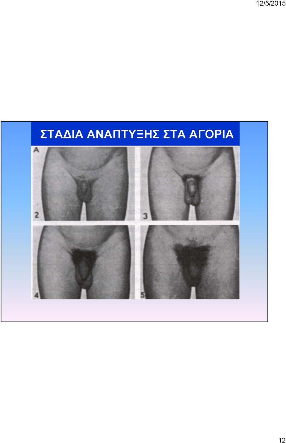 ΣΤΑ