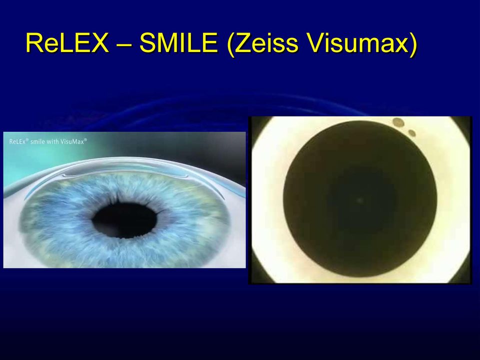 (Zeiss