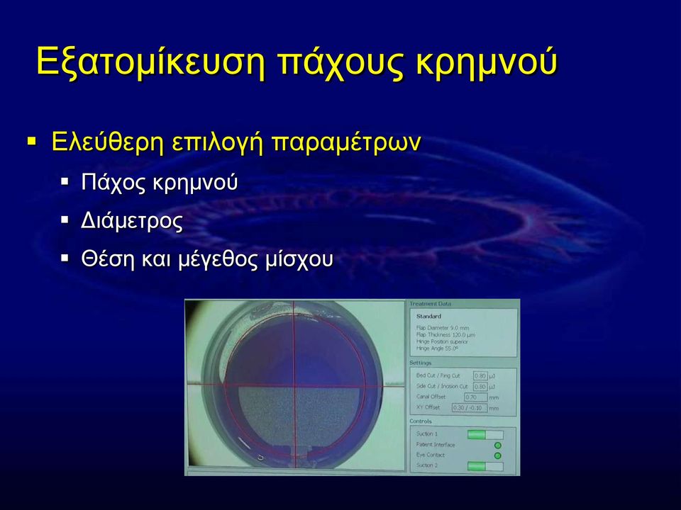παξακέηξσλ Πάρνο θξεκλνύ