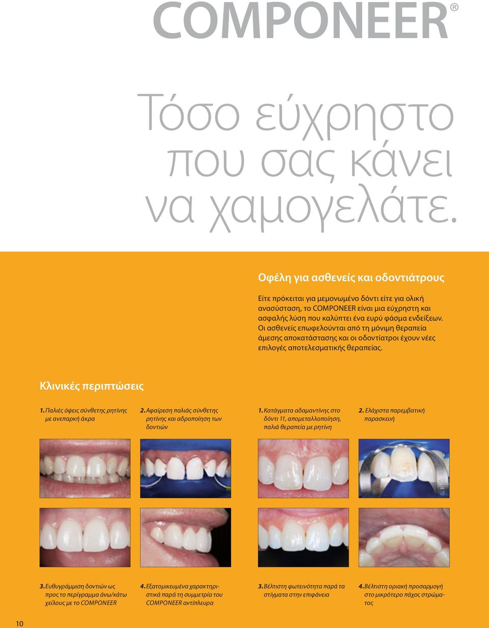 Οι ασθενείς επωφελούνται από τη μόνιμη θεραπεία άμεσης αποκατάστασης και οι οδοντίατροι έχουν νέες επιλογές αποτελεσματικής θεραπείας. Κλινικές περιπτώσεις 1.