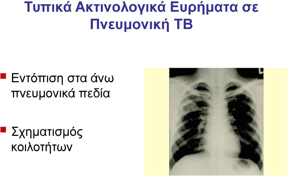 Εντόπιση στα άνω