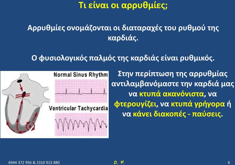Στην περίπτωση της αρρυθμίας αντιλαμβανόμαστε την καρδιά μας να κτυπά