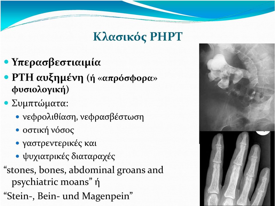 νόσος γαστρεντερικές και ψυχιατρικές διαταραχές stones, bones,