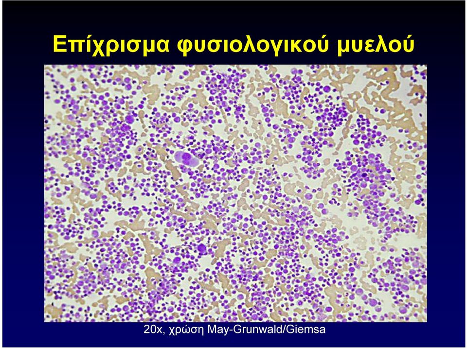 μυελού 20x,