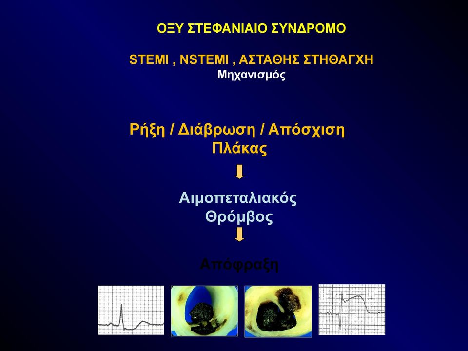 Μηχανισμός Ρήξη / Διάβρωση /