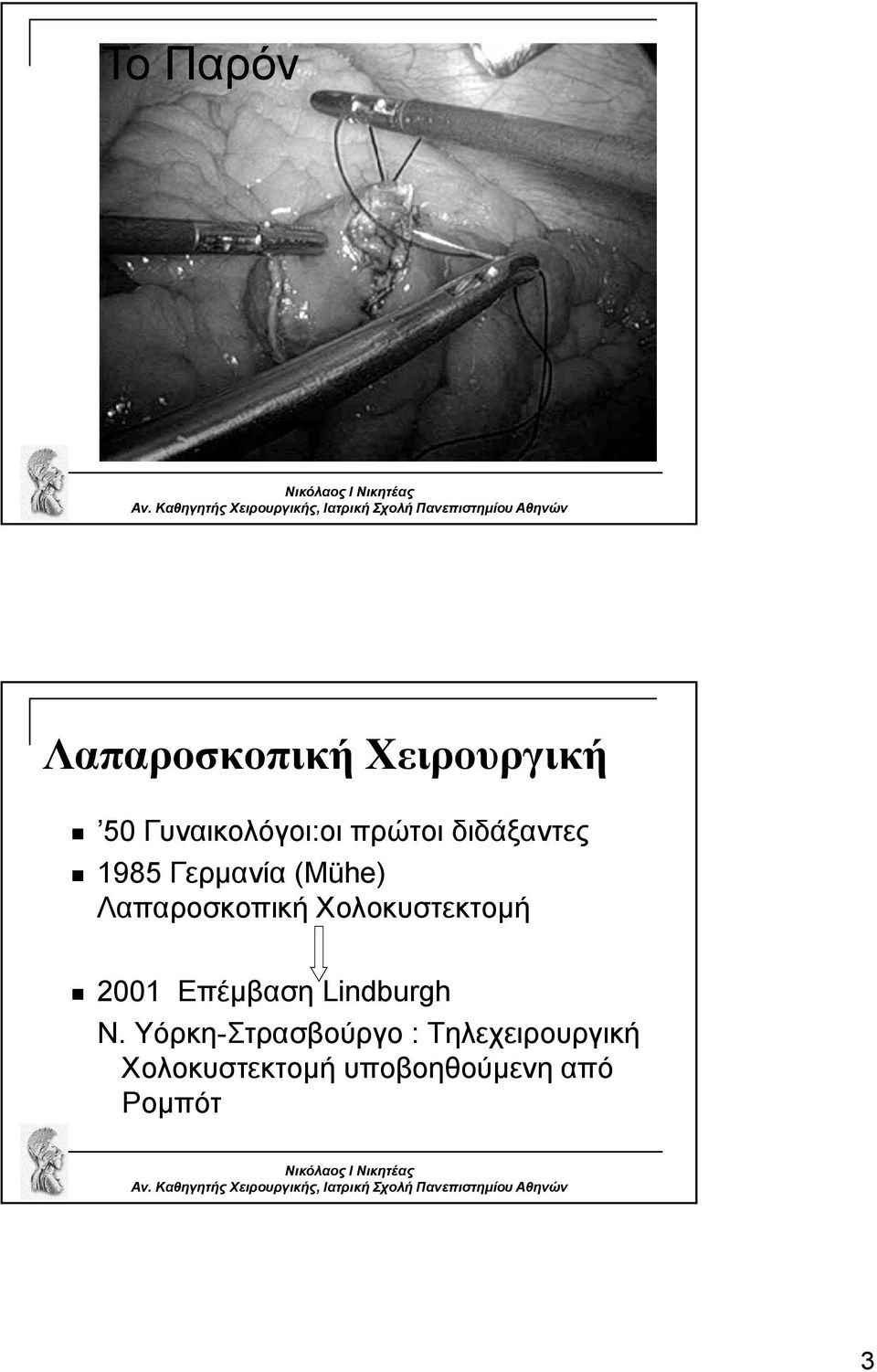 Χολοκυστεκτομή 2001 Επέμβαση Lindburgh Ν.