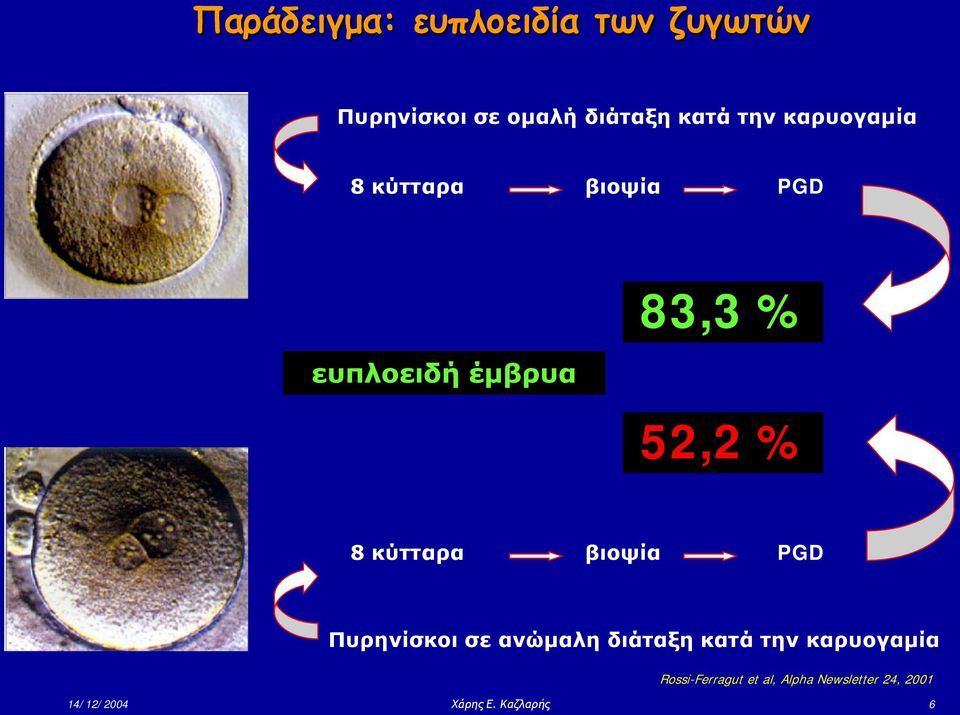 κύτταρα βιοψία PGD Πυρηνίσκοι σε ανώμαλη διάταξη κατά την καρυογαμία