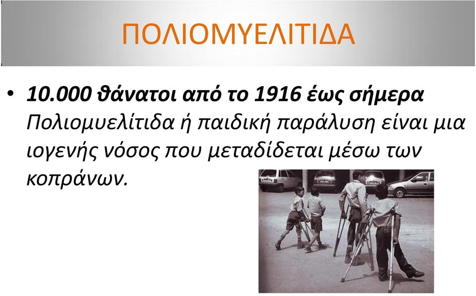 Πολιομυελίτιδα ή παιδική παράλυση