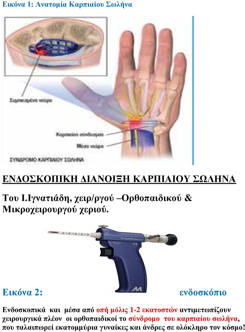 Εικόνα 2: ενδοσκόπιο Ενδοσκοπικά και μέσα από οπή μόλις 1-2 εκατοστών αντιμετωπίζουν