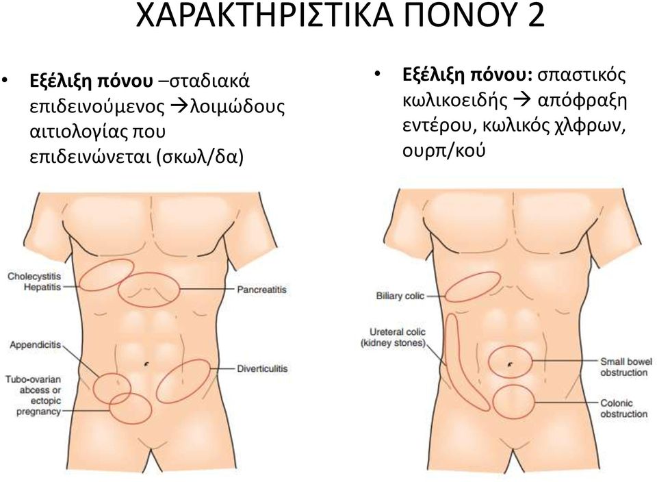 επιδεινώνεται (σκωλ/δα) Εξέλιξη πόνου: