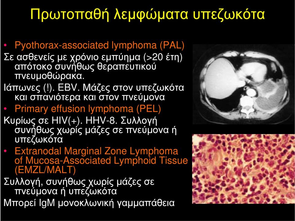 Μάζες στον υπεζωκότα και σπανιότερα και στον πνεύμονα Primary effusion lymphoma (PEL) Κυρίως σε HIV(+). HHV-8.