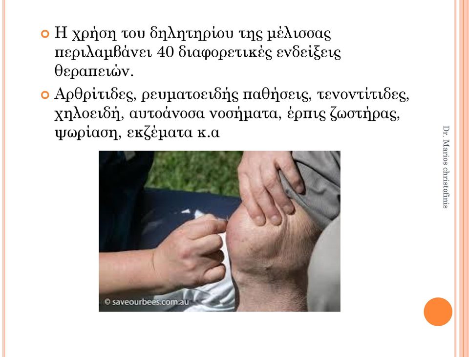 Αρθρίτιδες, ρευματοειδής παθήσεις, τενοντίτιδες,