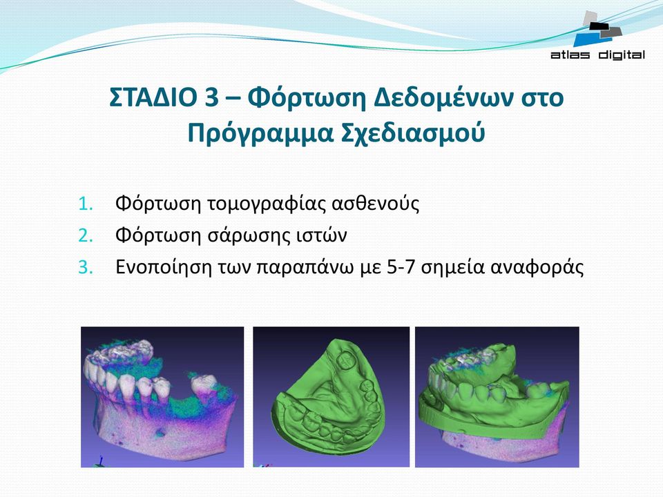 Φόρτωση τομογραφίας ασθενούς 2.