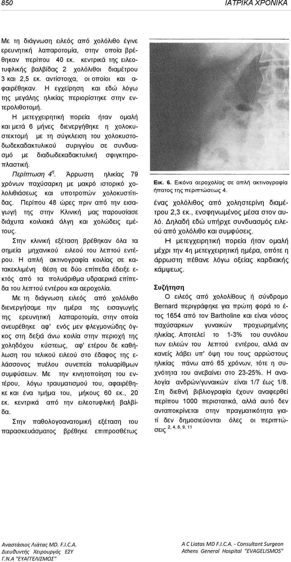 Η μετεγχειρητική πορεία ήταν οµαλή και μετά 6 μήνες διενεργήθηκε η χολοκυστεκτομή µε τη σύγκλειση του χολοκυστοδωδεκαδακτυλικού συριγγίου σε συνδυασμό µε διαδωδεκαδακτυλική σφιγκτηροπλαστική.