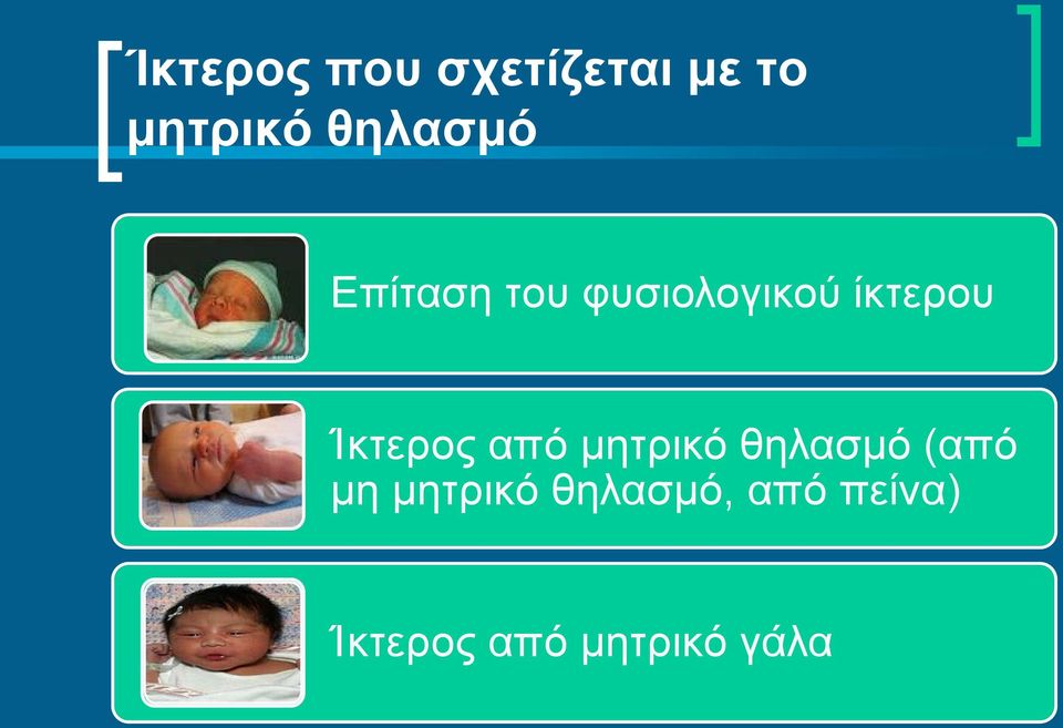 Ίκτερος από μητρικό θηλασμό (από μη