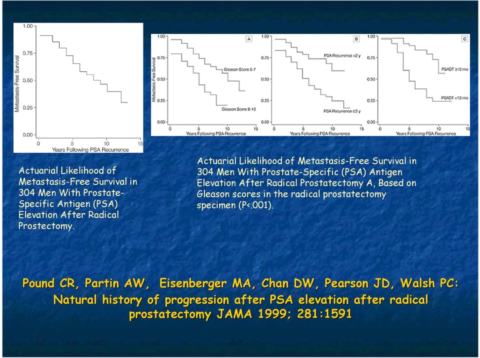 Actuarial Likelihood of Metastasis-Free Survival in 304 Men With Prostate-Specific (PSA) Antigen Elevation After Radical