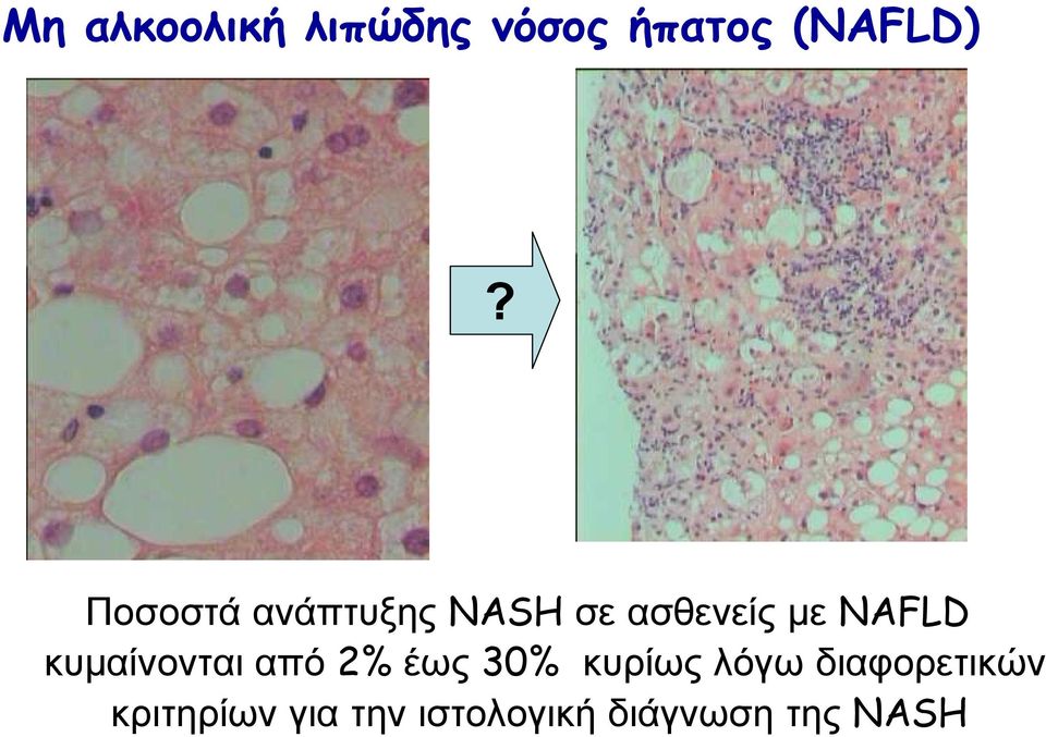 κυµαίνονται από 2% έως 30% κυρίως λόγω